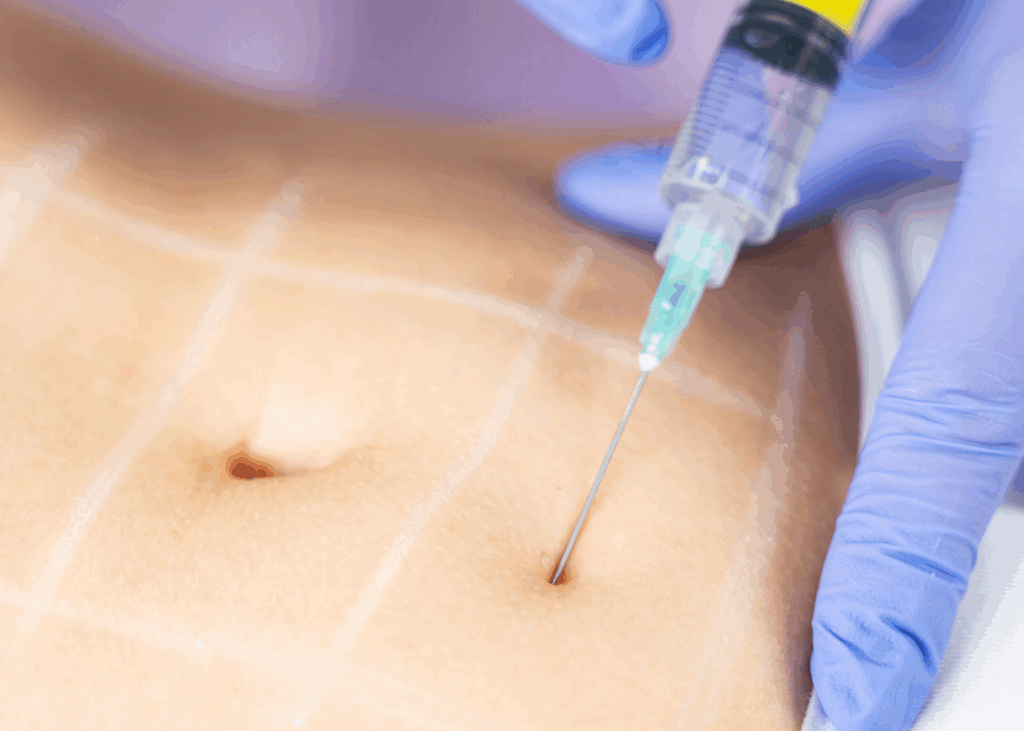 A close-up of a person undergoing tattoo removal with a laser, highlighting the procedure in a medical environment.