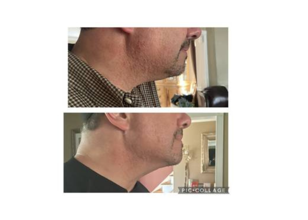 a picture of a man with his before and after photo