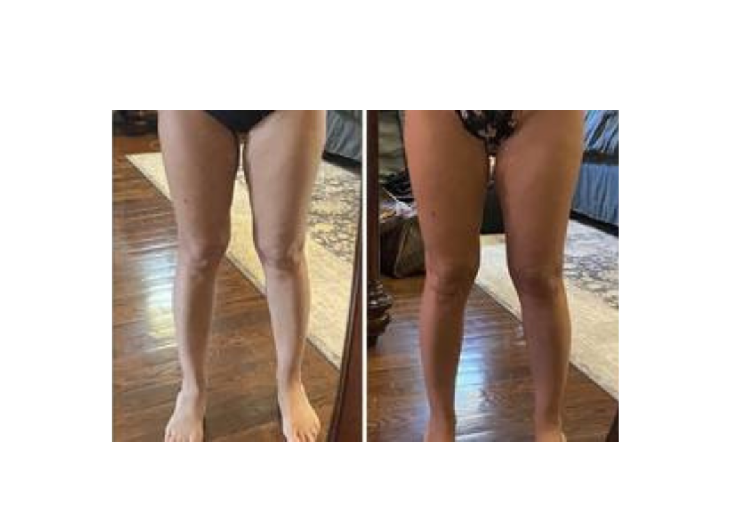 Side-by-side images of a woman's legs showing the difference before and after a tanning session.